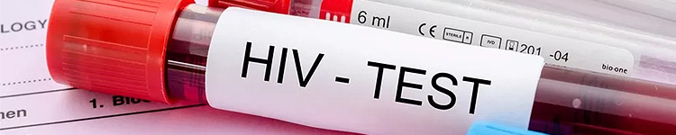 Анализы на ВИЧ в Бибирево